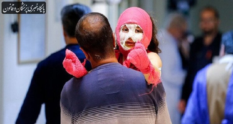 مصدوم شدن ۱۴۱ نفر از صبح امروز تا کنون با مواد محترقه مصدوم شدن ۱۴۱ نفر از صبح امروز تا کنون با مواد محترقه