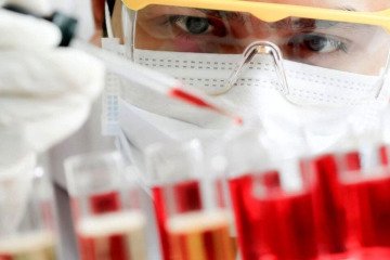 خون محیطی موبیلیزه، بهترین منبع پیوند سلول‌های بنیادی خون‌ساز