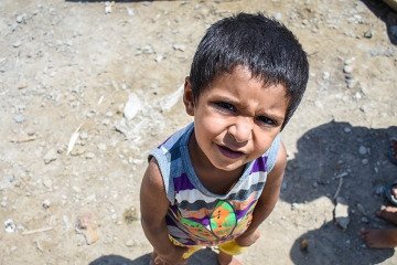 حمایت از ۲۰۰ هزار کودک مبتلا به سوء تغذیه در کشور