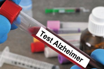 نخستین آزمایش خون برای تشخیص آلزایمر در آمریکا مجوز گرفت
