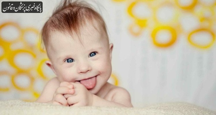 مبتلایان سندرم داون در معرض خطر بیشتر سکته مغزی و حمله قلبی