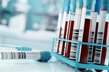 پیش‌بینی سرطان در مراحل اولیه با آزمایش خون