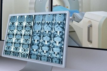 ایران بیش از ۹۰ درصد خدمات پزشکی هسته‌ای را در کشور ارائه می‌دهد