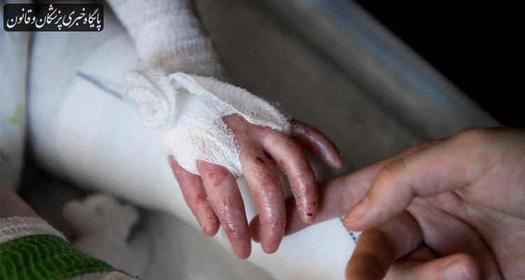 پانسمانهای تخصصی بیماران پروانه ای تحویل شد پانسمانهای تخصصی بیماران پروانه ای تحویل شد