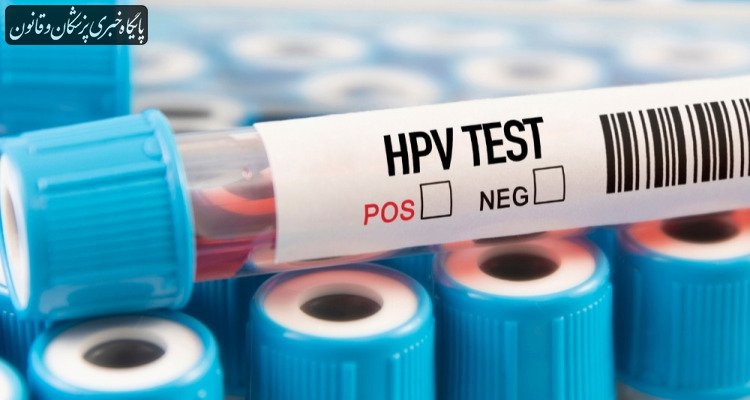 تست HPV خانگی شرکت BD در آستانه تایید FDA، گامی مهم در پیشگیری از سرطان دهانه رحم تست HPV خانگی شرکت BD در آستانه تایید FDA، گامی مهم در پیشگیری از سرطان دهانه رحم
