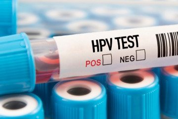 تست HPV خانگی شرکت BD در آستانه تایید FDA، گامی مهم در پیشگیری از سرطان دهانه رحم
