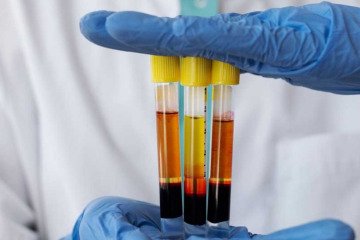 هشدار دیوان محاسبات نسبت به صادرات غیراصولی پلاسمای خون