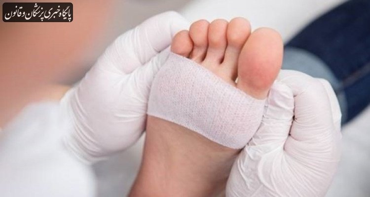 آموزش و پیشگیری، کلید کاهش عوارض زخم‌های مزمن