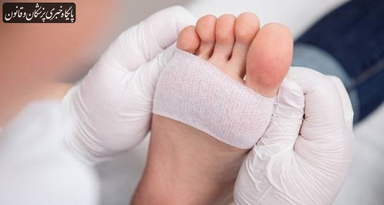 چالش زخم‌های مزمن و عدم ورود جدی بیمه‌ها به این عرصه