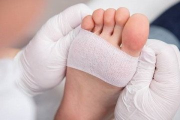 چالش زخم‌های مزمن و عدم ورود جدی بیمه‌ها به این عرصه