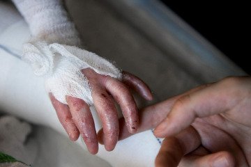 فهرست خدمات قابل ارایه به بیماران ایبی را اعلام کنید فهرست خدمات قابل ارایه به بیماران ایبی را اعلام کنید