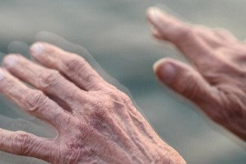 یک عامل تشدیدکننده خطر پارکینسون یک عامل تشدیدکننده خطر پارکینسون