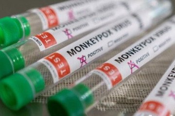 «ام پاکس» در کشورهای بیشتری شناسایی شده است