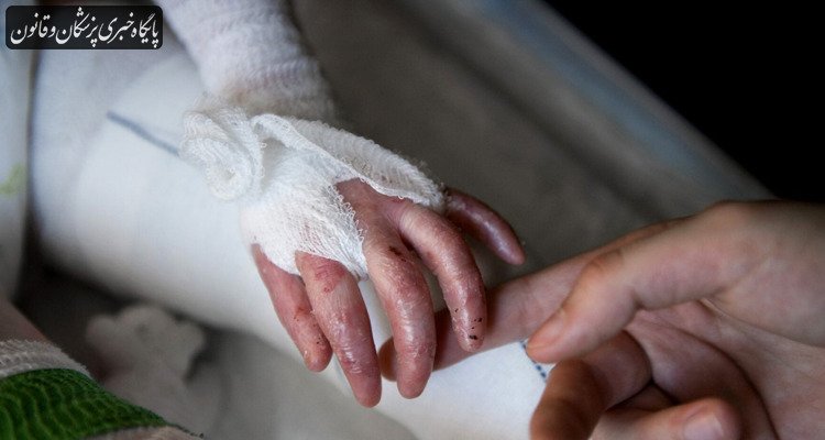 مهمترین نیاز بیماران ایبی استفاده از پانسمانهای تخصصی است مهمترین نیاز بیماران ایبی استفاده از پانسمانهای تخصصی است