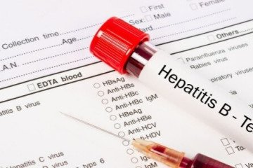 هپاتیت نوع B در ایران شایع‌تر از هپاتیت C است