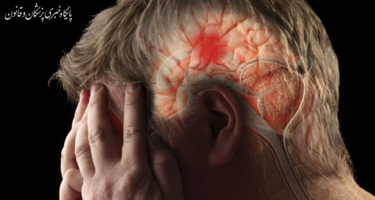 سکته مغزی دومین علت مرگ و میر در ایران است