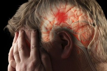 سکته مغزی دومین علت مرگ و میر در ایران است