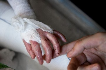 ضرورت اطلاع‌رسانی درباره ازدواج‌های فامیلی و بیماری‌های ژنتیکی