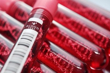 ذخیره استراتژیک داروهای حیاتی بیماران هموفیلی تمام شده است