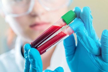 تفسیر غیرتخصصی نتایج آزمایش‌های پزشکی توسط سامانه‌های هوش مصنوعی