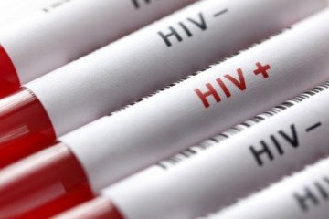 «من هم تست اچ‌آی‌وی می‌دهم»