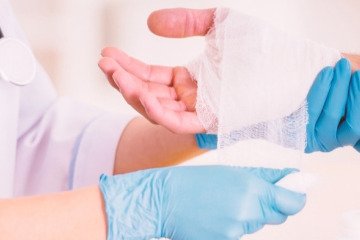 سالانه حدود ۳۰۰ هزار مورد سوختگی در کشور رخ می‌دهد