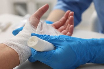 سوختگی‌های ناشی از اسید، چالشی برای جراحان ترمیمی