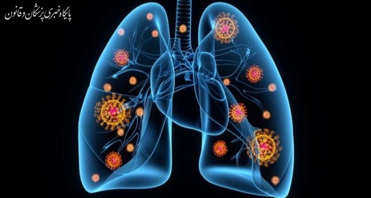 پنومونی همچنان به عنوان بزرگترین قاتل عفونی جهان