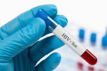 بیش از ۴۱ هزار نفر در کشور به HIV مبتلا هستند