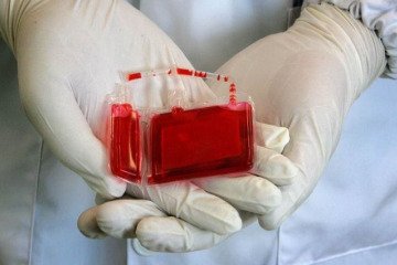 ذخیره‌سازی ۲۵۰ هزار نمونه خون بند ناف