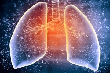 موارد ابتلا به سل در جهان به بالاترین حد خود رسیده است