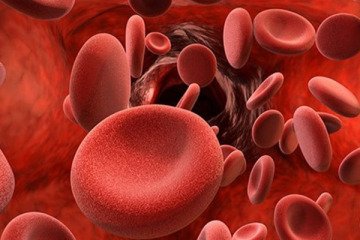 ایران در مسیر درمان فلج مغزی کودکان