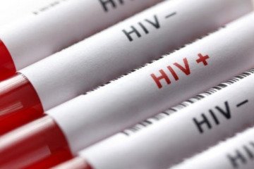 تعداد افراد شناسایی‌شده مبتلا به HIV در ایران ۲۵٬۸۷۰ نفر اعلام شده است