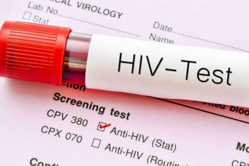 هدف اصلی در مسیر نجات فرد مبتلا به HIV، کاهش تعداد ویروس در بدن اوست