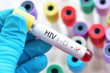 وضعیت ابتلا به HIV در سطح جهان