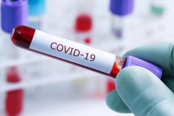 فقط ۲ درصد عفونت های تنفسی مربوط به کرونا است