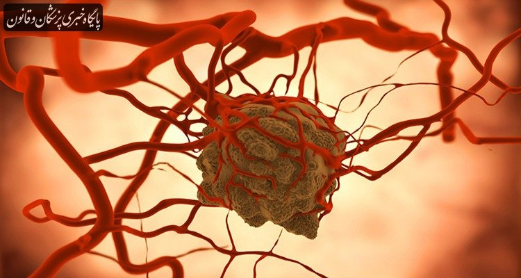 ۵۰ درصد مردم حتی نمی‌توانند یک علامت سرطان را نام ببرند