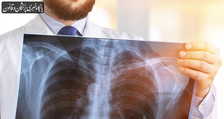 شیوع گسترده بیماری‌های انسدادی مزمن ریوی «COPD»