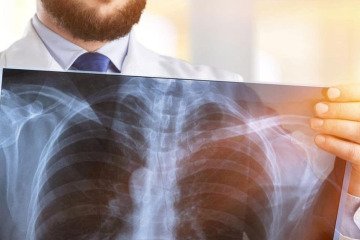 شیوع گسترده بیماری‌های انسدادی مزمن ریوی «COPD»