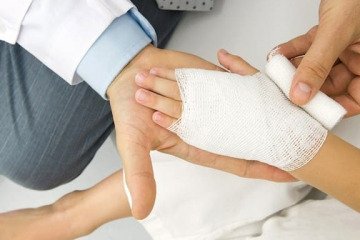 سالانه حدود ۳۰۰ هزار نفر به مراکز سوختگی کشور مراجعه می‌کنند