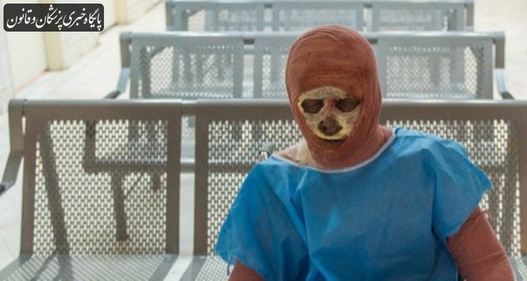 پوشش بیمه‌ای پانسمان‌های نوین سوختگی