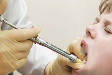 احتمال فروش آزاد کارپول‌های دندانپزشکی به دلیل ضعف در نظارت