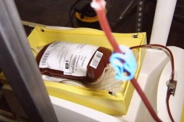 رشد اهدای خون کمتر از نیاز بیمارستان‌هاست