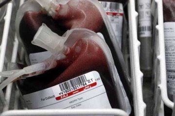 نیاز گسترده مبتلایان سرطان به فرآورده‌های خونی