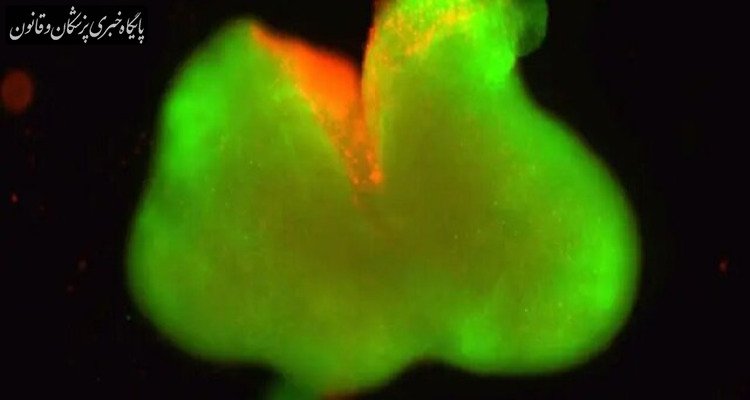 دستاوردی قابل توجه در ترمیم نخاع