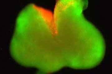 دستاوردی قابل توجه در ترمیم نخاع