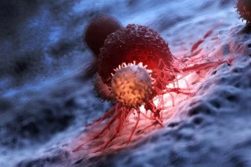 مدیریت علمی درد سرطان با کمترین عارضه