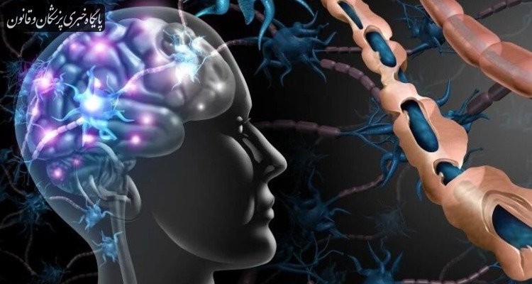 ام‌اِس ممکن است بیش از یک دهه پیش از بروز علائم آغاز شود