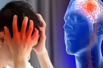 ساز ناکوک ساعت طلایی درمان سکته مغزی