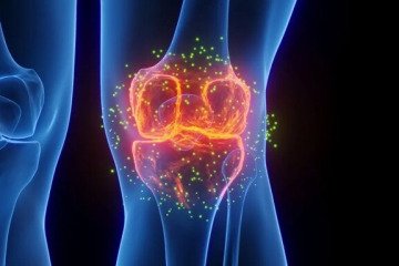 پیشگیری از آرتروز با امواج فراصوت